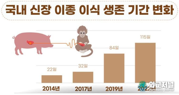 국내 이종 이식 기술